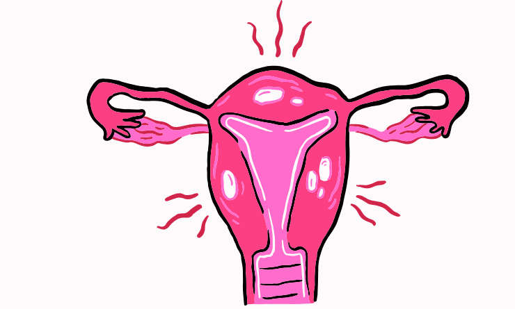 Best Diet to Control PCOS (Polycystic Ovary Syndrome) in India